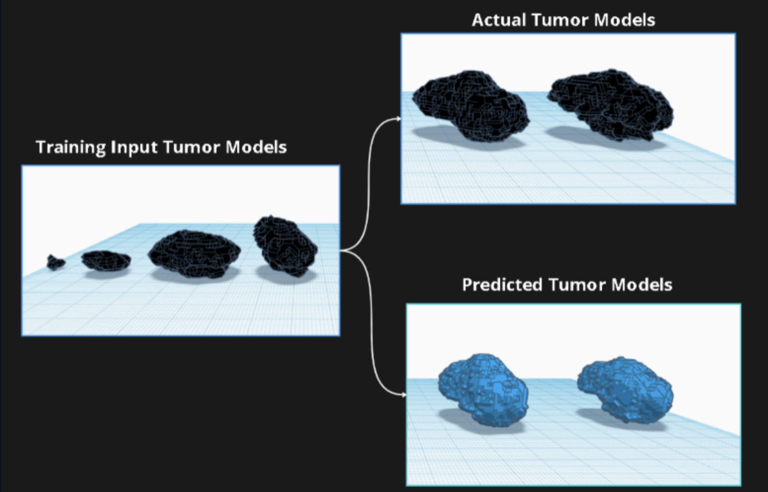3D brain tumor growth evolution webapp